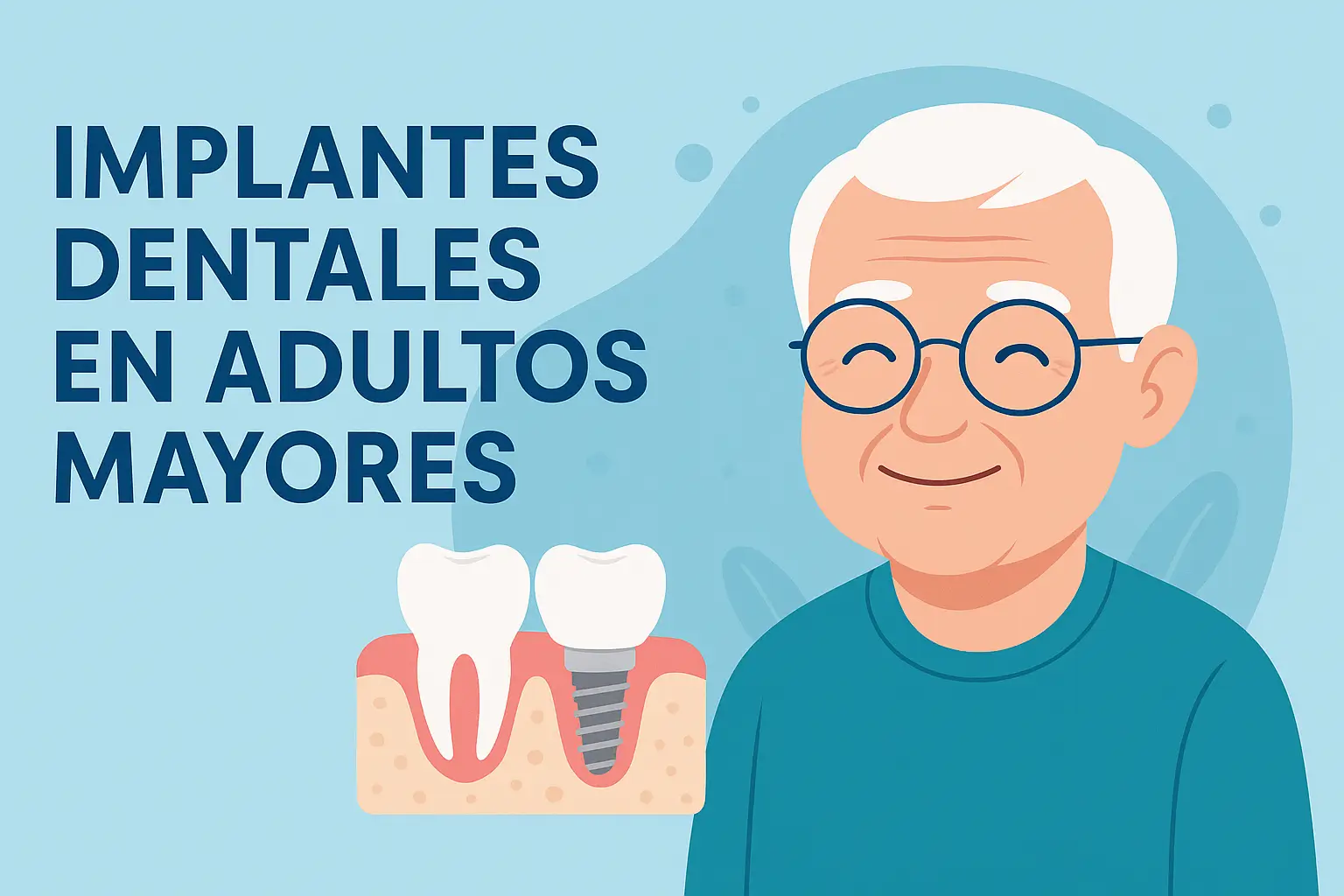 Implantes dentales en adultos mayores: una solución duradera para recuperar la sonrisa