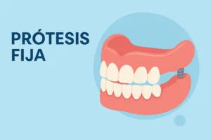 Prótesis Fija